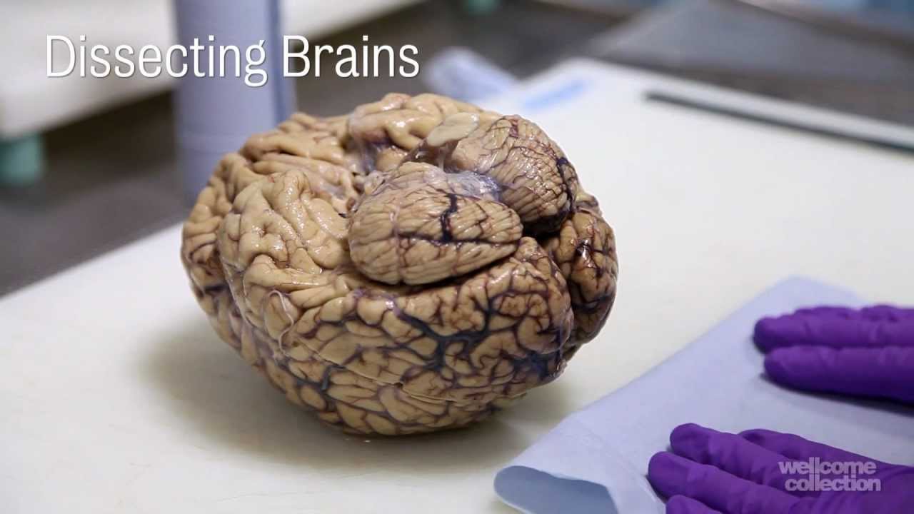 Featured image of post Real Human Brain Pictures